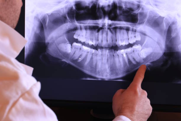 Best Broken or Cracked Tooth Emergency Dentist in Coralville, IA