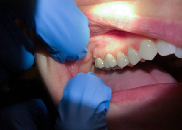 Best Weekend Emergency Dentist in Coralville, IA