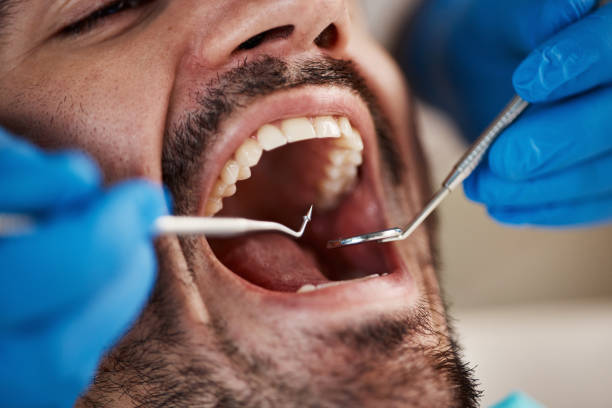 Best Holiday Emergency Dentist in Coralville, IA